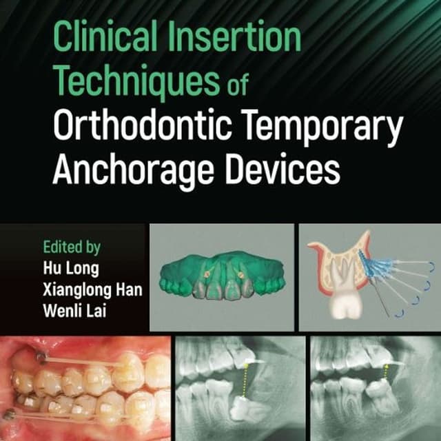 Clinical Insertion Techniques of Orthodontic Temporary Anchorage Devices