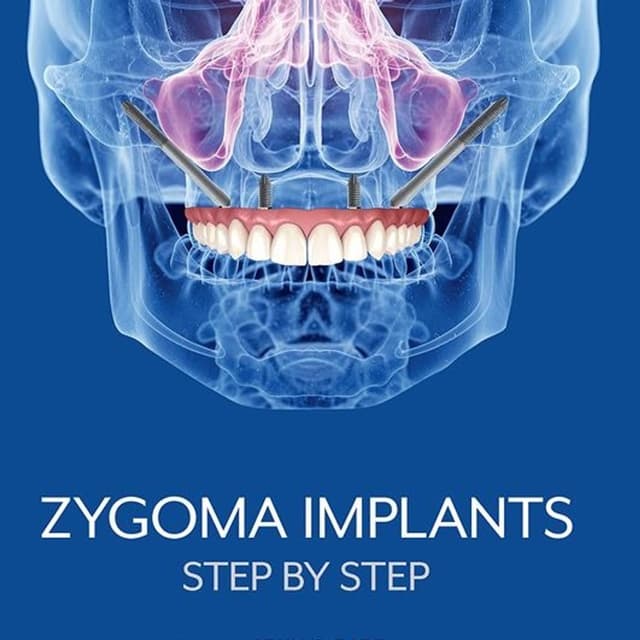 Zygoma Implants: Step By Step