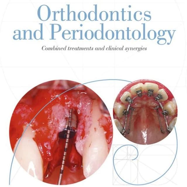 Orthodontics and Periodontology: Combined treatments and clinical synergies