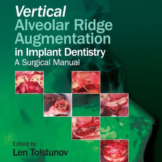 Vertical Alveolar Ridge Augmentation in Implant Dentistry: A Surgical Manual
