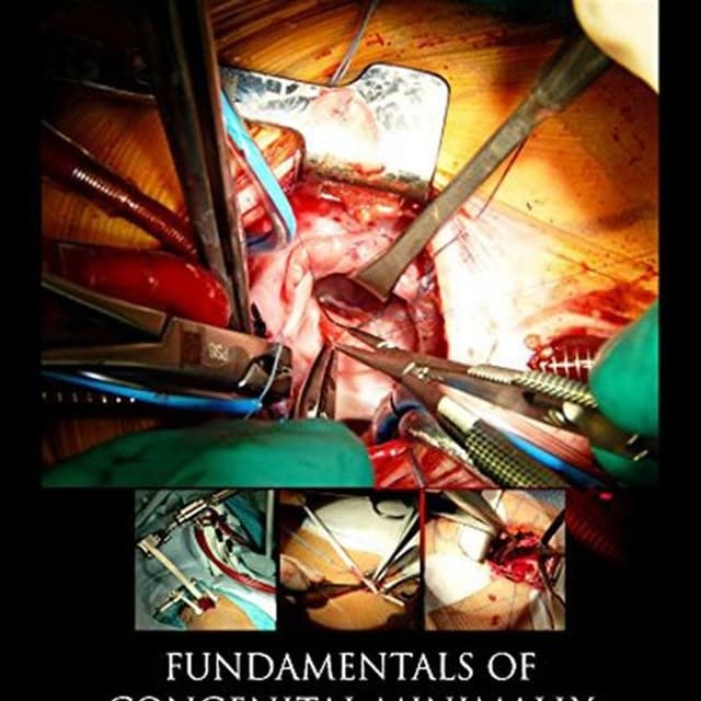 Fundamentals of Congenital Minimally Invasive Cardiac Surgery